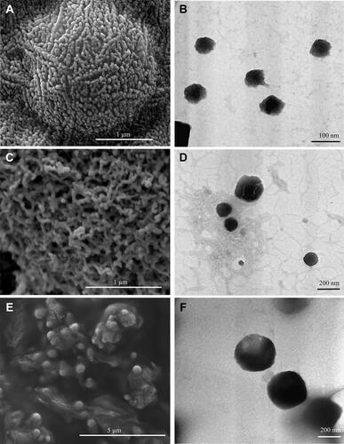 Figure 9 SEM micrographs of (A) TP2, (C) DTP2, (E) fDTP2. TEM micrographs of (B) TP2, (D) DTP2, (F) fDTP2.