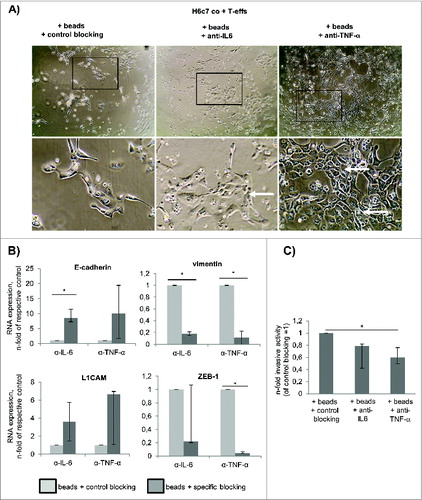 Figure 8. TNF-α and IL-6 account for the acquisition of the mesenchymal and invasive phenotype of H6c7 cells during co-culture with activated CD4+ T-effs. H6c7 cells were directly co-cultured with T-effs (co T-effs) and activation beads (+ beads) for 72 h. As indicated, 10 μg/mL of Rituximab (control blocking) or blocking agents specific for IL-6 (Tocilizumab) or TNF-α (Etanercept) were added during co-culture. (A) Representative images of three independent experiments showing cell morphologies of differentially treated H6c7 cells during T-eff co-culture. Magnification x 280 (upper panel) and x 560 (lower panel). (B) E-cadherin, L1CAM, vimentin and ZEB-1 expression were analyzed by RT-qPCR. TBP was used as house-keeping gene for control. Data represent the median values with quartiles quartiles (Q0,75 as upper, Q0.25 as lower deviation) of 3–4 independent experiments. (C) Cell invasion of differentially treated H6c7 cells was determined in a modified boyden chamber on collagen-I coated transwells after 24 h. Median values with quartiles (Q0,75 as upper, Q0.25 as lower deviation) of % invaded cells from three independent experiments with T cells isolated from three individual donors are shown. * = p < 0.05.