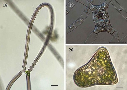 Fig. 18-20. Fig. 18 Conjugation between cells of the same filament forming a loop (LM); Fig. 19. Two young zygospores in a filament (LM); Fig. 20 Side view triangular of zygospores (LM).  Figs 18, 20 Scale bar = 20 μm, Fig. 19. Scale bar = 50 μm