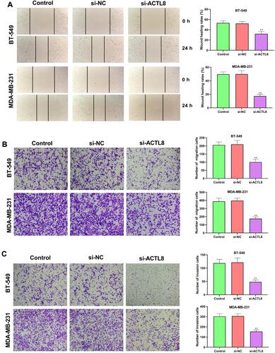 Figure 4 Silencing ACTL8 suppressed the migration and invasion abilities in MDA-MB-231 and BT-549 cells. (A) Wound healing assay was used to assess the migration of the transfected MDA-MB-231 and BT-549 cells. (B) Transwell assay was executed to detect the migration of the transfected MDA-MB-231 and BT-549 cells. (C) Transwell assay was executed to detect the invasion of the transfected MDA-MB-231 and BT-549 cells. **P < 0.01, vs Control and si-NC group.