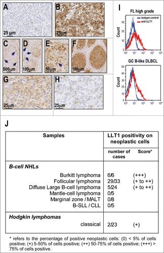 Figure 4. LLT1 expression in primary B-cell NHLs. (A–H) Representative IHC staining with anti-LLT1 mAb (clone 2F1) of lymph node biopsies from patients: (A) gastric marginal B-cell lymphoma (MALT type); (B) Burkitt lymphoma; (C–E) low grade follicular lymphoma; (F) high grade follicular lymphoma; (G) Diffuse large B-cell lymphoma of GC type and (H) DLBCL of activated B-cell type. (C–E) Of note, the level of expression in low grade FL appears heterogenous within the neoplastic follicles (arrows) due to a stronger expression in centroblasts than in centrocytes. Accordingly, the expression appears higher in high grade FL (F) than in low grade FL (C–E). (I) LLT1 cell surface expression on the indicated primary NHLs monitored by flow cytometry with anti-LLT1 (clone 4F68). (J) Summary of immunohistochemical analysis of LLT1 expression in lymphoid neoplasms.