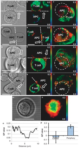 Figure 2. Membrane order at the synapse of live T cell-APC conjugates. (a) brightfield, (b) GP image and (c) 3D reconstruction showing en face view of the cell-cell interface (dashed line viewed from the direction of the arrow on b; APC position is indicated by dashed ring) of live di-4-ANEPPDHQ-stained Jurkat T cells forming synapses with unstained APCs (SEE-loaded Raji cells). (d, e and f) second example showing similar order distribution. APC (not shown) position in f is indicated with dashed circle and the other T cell is not shown for clarity (representative of n = 8). (g, h and i) and (j, k and l) show two examples of the synapses formed in the absence of antigenic stimulus (SEE; representative of n = 16). The total acquisition time for the 3D stack was approximately 30 sec with both images acquired approximately 10 min after synapse formation. In all images, red colour represents higher and green/blue lower order membranes. Scale bars 10 μm. T cell synapses imaged using optical tweezers: Brightfield (m) and GP image (n) of the activatory conjugate formed between Jurkat T cell and APC (as in a) with the IS oriented in the focal plane using optical tweezers. Representative line profile across the synapse (o) and quantitation of the GP values in the central and peripheral regions (n = 8, p < 0.05) (p). Scale bar 10 μm. This Figure is reproduced in colour in the online version of Molecular Membrane Biology.