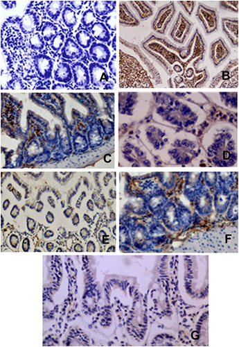 Figure 2 Immunohistochemical analysis of CD3 expression in intestinal mice tissues of different groups: the control group and T1, T2, T3, T4, T5, and T6 were represented in (A–G), respectively.