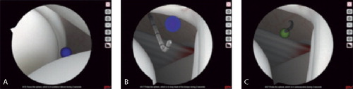 Figure 2. Locating the sphere (A). Palpating the sphere with the probe (B). Touching the sphere for 2 seconds (C).