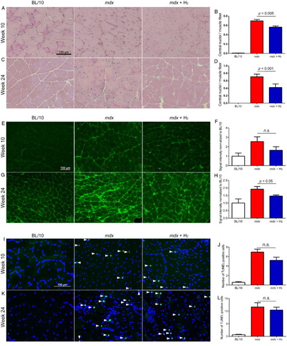 Figure 3 Histological analyses of gastrocnemius muscles at ages 10 (n = 6) and 24 (n = 4) weeks. (A–D) Hematoxylin-eosin staining of gastrocnemius muscles. Central nuclei are barely detectable in BL/10 mice, whereas they are frequently observed in untreated (mdx) and hydrogen-treated (mdx + H2) mdx mice (A and C). The number of central nuclei is divided by the number of muscle fibers (B and D). (E–H) Nitrotyrosine immunostaining of gastrocnemius muscle. Representative images of BL/10 mice, mdx, and mdx + H2 are indicated (E and G). As the secondary antibody is against mouse IgG, background signals may include incidental IgG in addition to nitrotyrosine. Morphometric analysis of signal intensities of nitrotyrosine (F and H). (I–L) TUNEL staining of gastrocnemius muscle. Representative images of BL/10 mice, mdx, and mdx + H2 are indicated (I and K). The numbers of TUNEL-positive nuclei (arrowheads) are counted in each group of mice (J and L). Data are expressed by the mean and SEM (n = 36 visual fields at age 10 weeks and n = 40 visual fields at age 24 weeks). Statistical difference is calculated with Student's t-test.