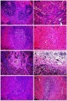 Figure 3 Histopathological alterations in splenic sections of rats in different groups. (A) Spleen of rat in the control group showing normal histology of both red (arrowhead) and white pulp (star). (B–F) Spleen of rat in the group that received 50 mg/kg Ch-AgNPs, showing (B) splenic hemorrhage (arrows) with hemosiderin pigment deposition in the red pulp; (C) lymphoid cell depletion with presence of many tangible body macrophages (arrows) detected within the splenic periarteriolar lymphoid follicles; (D) splenic hemorrhage (arrows) and fibrin threads (star) fill the splenic sinusoids in the red pulp; (E) deposition of hemosiderin pigment in the splenic parenchyma as well as congestion of central artery (star) with extensive lymphoid depletion (arrow) associated with reticular cell hyperplasia (arrowhead) in the white pulp; (F) thickening of the splenic capsule by fibrin deposition (star), edema and mononuclear inflammatory cell infiltrations (arrow). (G) Spleen of rat in the group that received 25 mg/kg Ch-AgNPs showing mild lymphoid depletion in the splenic lymphoid follicles. (H) Spleen of rat in the group that received 10 mg/kg Ch-AgNPs showing normal histology of both white (star) and red pulp.Note: All sections stained by H&E.