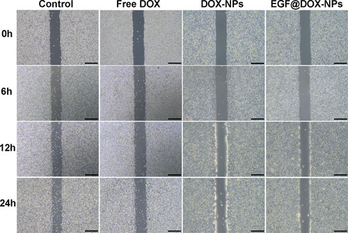Figure 5. Typical images of wound healing of A549 monolayer after treatment with different drugs for 0, 6, 12, and 24 h (DOX concentration: 1 µg/mL; Scale bar: 500 µm).