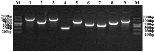 Figure 5. Agarose gel electrophoresis of PCR assay for detection of steroid estrogen degrading enzyme genes.
