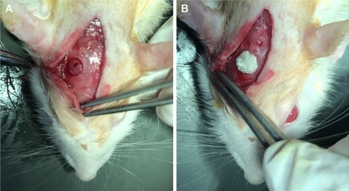 Figure 8 Skull-penetrating defect model of SD rats.Notes: (A) The parietal calvarium defect of SD rat. (B) 50 mg ACS-CCM implanted in the defect.Abbreviations: SD, Sprague-Dawley; ACS-CCM, aspirin-loaded chitosan nanoparticles contained in collagen-chitosan membranes.