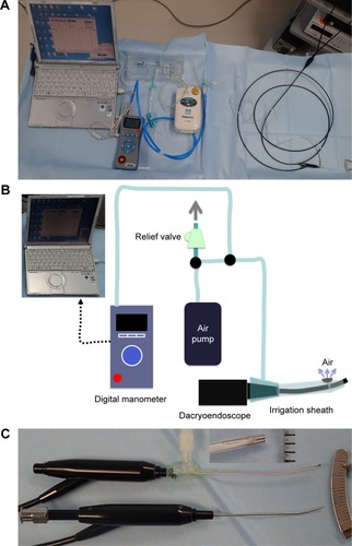 Figure 1 Instruments used to perform dacryoendoscopy. (A) The digital manometer-based pressure-controlled air-insufflation system. The digital manometer and relief valve were connected to the air tube with a three-way stopcock. (B) The schema of the digital manometer-based pressure-controlled air-insufflation system. (C) Photograph of the high-definition dacryoendoscopes: the high-definition dacryoendoscope with custom-made sheath (top and inset) and the conventional dacryoendoscope (bottom).