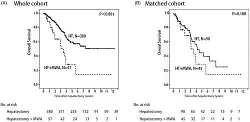 Figure 4. Overall survival in patients who underwent hepatectomy alone and following microwave ablation (MWA) in combination with hepatectomy: A whole cohort and B match cohort (p<.001 and p=.180, respectively) (log rank test).