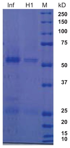 Figure 1 Polyacrylamide gel electrophoresis of influenza A and H1N1 proteins. Lane 1, influenza A virus vaccine; lane 2, H1N1 virus vaccine; lane 3, broad weight molecular weight marker.