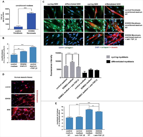 Figure 3. EDMD2 fibroblast medium induces TGF β2-dependent fibrogenic conversion in NHM cultures. (A) TGF β2 secretion in control and EDMD2 fibroblast culture medium. (B) Quantification of myofibroblasts in cultures of control human myoblasts maintained in medium conditioned by control (control) or EDMD2 (EDMD2) fibroblasts or treated with TGF β2 (control + TGF β2). The number of myofibroblasts was determined by counting alpha-SMA positive mononucleated cells (200 cells/sample were counted in three independent experiments). (C) Immunofluorescence staining of collagen I (green) and desmin (red) in cycling and differentiated NHM cultured in presence of medium conditioned by control or EDMD2 fibroblasts, treated (anti-TGFβ2) or not (NT) with anti-TGF β2 neutralizing antibodies. Nuclei were stained with DAPI. Bar: 10µm. (D) Immunofluorescence staining of ED-fibronectin (red) in cryosections of muscle tissue isolated from healthy donors (control), EDMD2 patients (EDMD2) or Becker muscular dystrophy patients (BMD). Nuclei were stained with DAPI. BMD tissue was used as positive control. In control muscle, ED-fibronectin is restricted to the area surrounding blood vessels. Bar: 10µm. (E) Quantitative analysis of proliferating cells in NHM cultures maintained in medium conditioned by control or EDMD2 fibroblasts, treated (anti-TGF β2) or not (NT) with anti-TGF β2 neutralizing antibodies. The number of proliferating cells was determined by flow cytometry. Means ± standard deviation are shown in graphs. Statistically significant differences are indicated by double asterisk (p<0.01) or triple asterisk (p< 0.001).