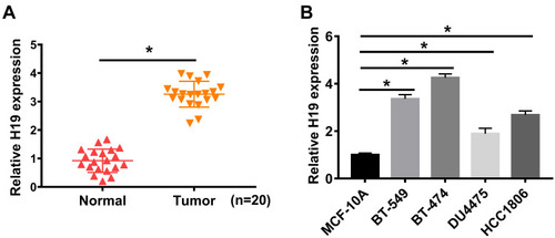 Figure 1 H19 was highly expressed in the breast cancer tissues and cells. (A and B) QRT-PCR assay was performed to detect the expression of H19 in breast tissues (n=20) and cell lines (MCF-10A, BT-549, BT-474, DU4475 and HCC1806). *P<0.05.