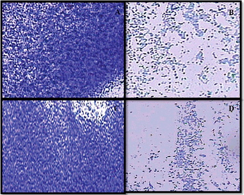 Figure 6. Inhibition of biofilm of MRSA isolate at sub-MICs of eugenol under light microscopy: (A) FSA13 untreated control, (B) 1/2 × MIC of eugenol, (C) FSA32 untreated control and (D) 1/2 × MIC of eugenol.