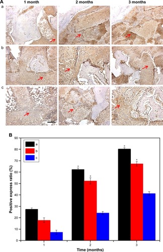 Figure 9 Images (A) of immunohistological staining of type I collagen expression (brown: arrows, scale bar: 200 µm), and quantitative analysis of type I collagen expression (B) after 30 MGPC (a), 15 MGPC (b), and GPC (c) scaffolds were implanted into femoral defects of rabbits for 1, 2, and 3 months, *P<0.05.Note: The magnification of Figure A is ×200.Abbreviations: GA, gliadin; MGPC, mMCS/GA/PCL composites; mMCS, mesoporous magnesium calcium silicate; PCL, polycaprolactone.