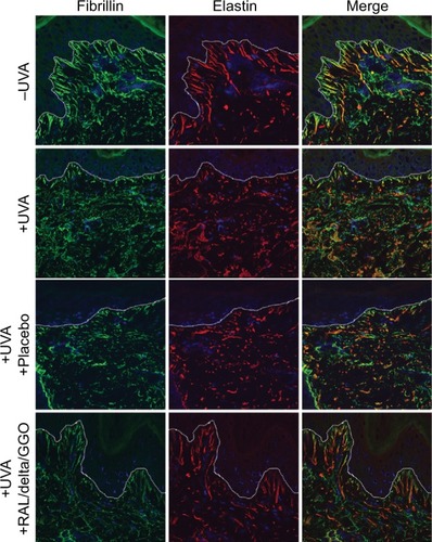 Figure 2 Not irradiated (−UVA), UVA-irradiated (+UVA) and UVA-irradiated human skin explants treated with a placebo or a preformulation containing a combination of RAL/delta-TC/GGO assessed by using immunohistochemistry and confocal microscopy.