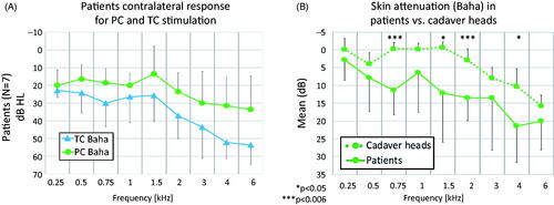 Figure 4. Comparison of TC and PC response (A) in patients and corresponding skin attenuation (B) in patients versus cadaver heads, all under Baha stimulation. In (A), the y-axis shows dB HL based on PC Baha calibration. In (B), the y-axis shows TC contralateral PM or HL relative to PC contralateral PM or HL. All data is shown as means and standard deviations. Significant differences (p ≤ 0.006) between patients and cadaver heads are marked with ***.