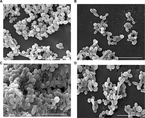 Figure 4 Scanning electron microscopy observation of C1 biofilms at 24 h (A) and 48 h (C) and after treatment with AuNPs–indolicidin (B, D). Scale bars correspond to 20 µm.