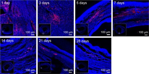 Figure 3 NPs maintaining in the myocardium.Notes: Representative images show the merging of fluorescent (showing rhodamine NPs in red) and blue field images (showing cell nuclei in blue) at 1-, 3-, 5-, 7-, 14-, 21- and 28-day time points. Scale bars, 100 µm. Inset pictures are cross sections of representative images.Abbreviation: NPs, nanoparticles.