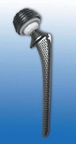 Figure 1. The Parhofer-Monch (PM) prosthesis. The conical threaded cup is made of titanium-aluminum-vanadium alloy with a smooth surface, resembling a typical design of the first generation of screw-rings.