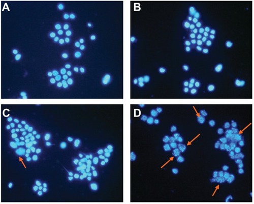 Figure 4 Nucleolus morphological changes of LOVO cells after treatment for 48 hours under fluorescence microscope (×400, DAPI staining). (A) Controls, (B) 60 μg/mL magnetic nanoparticles containing Fe3O4, (C) 0.35 μmol/L gambogic acid, and (D) magnetic nanoparticles containing Fe3O4 and gambogic acid (0.35 μmol/L gambogic acid with 60 μg/mL magnetic nanoparticles containing Fe3O4).