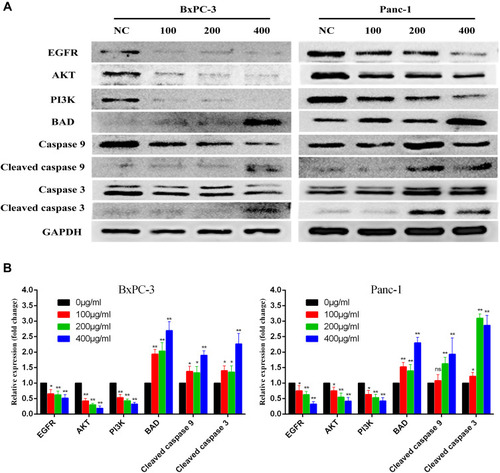 Figure 10 Relative expression of proteins related to ZJP treatment in pancreatic cancer cells. (A) Western Blotting revealed the changes of related proteins in BxPC-3 and Panc-1 cell lines after ZJP treatment; (B) Western Blotting statistical analysis showed that the expression levels of EGFR, AKT, and PI3K were down-regulated. Cleaved caspase 3/9 and BAD were up-regulated. *P < 0.05, **P < 0.01 versus the untreated group.