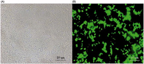 Figure 7. Infection efficiency of the pAd-CaMKIIγ-shRNA adenovirus under fluorescence microscope, scale bar =25 μm. A: DRG cells under visible light (×20). B: DRG cells under green fluorescence (×20).