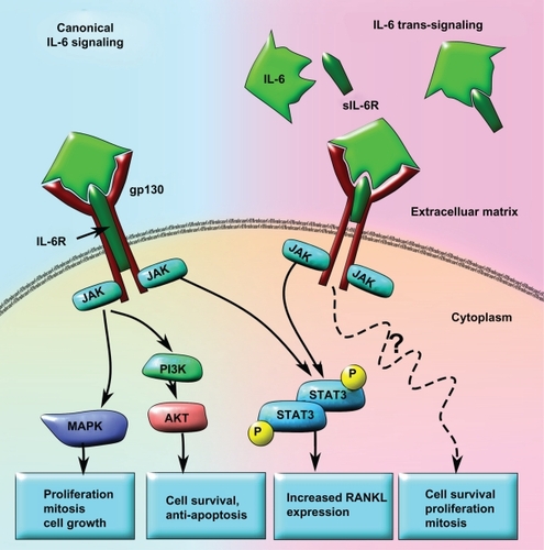 Figure 3 Model of canonical IL-6 signaling versus IL-6 trans-signaling in tumor progression and metastases. In the canonical IL-6 signaling pathway, the IL-6 receptor subunit is membrane bound and forms a heterotrimer with two gp130 subunits. When IL-6 binds to the receptor, STAT3 is activated in a JAK-dependent manner that leads to increased RANKL expression. IL-6 may also activate AKT via increased JAK-dependent PI3K activity and result in cell survival and anti-apoptosis signaling. Concomitantly, increased MAPK activity downstream of JAK activation can lead to upregulated cell growth, proliferation, and mitosis. In the IL-6 trans-signaling pathway, IL-6 first binds to the truncated sIL6R. The IL-6/sIL6R complex then binds to the membrane-bound gp130 dimer to form an IL-6 trans-signaling complex. Due to the fact that the sIL-6R lacks a membrane signaling domain, there appears to be significant differences in the intracellular signaling pathways. While IL-6 trans-signaling also leads to phosphorylation and activation of STAT3, increased cell survival, proliferation, and mitosis occurs in an AKT-and MAPK-independent manner. The exact mechanisms for IL-6 trans-signaling leading to increased cell survival, proliferation, and mitosis are not yet known.Abbreviations: IL-6, interleukin 6; JAK, Janus kinase; MAPK, mitogen-activated protein kinase; PI3K, phosphatidylinositol 3-kinase; RANKL, receptor activator of nuclear factor κB ligand; sIL6R, soluble IL-6 receptor; STAT3, signal transducer and activator of transcription 3.