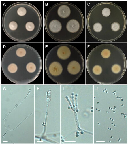 Figure 11. Morphology of Talaromyces georgiensis CNUFC DW211. (A, D) Colonies on Czapek yeast autolysate agar (CYA); (B, E) malt extract agar (MEA); (C, F) yeast extract sucrose agar (YES) (A–C: obverse view and D–F: reverse view); (G–I) Conidiophores; (J) Conidia. Scale bars = 10 µm.