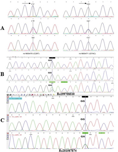Figure 1. Electropherogram wavelengths of sequenced samples. Analysis of the wavelengths of sequenced samples obtained from amplification of a fragment of exon 1 and exon 2 of TGF-β1 gene with a length of 494 bP and 383 bp, contain two important and two uncommon polymorphisms: A. RS1800470 polymorphism (left) and RS1800471 polymorphism (right) in exon 1; B. Rs199758510 in exon 1, C. Rs201567874 in exon 2. (arrow indicates polymorphic area).