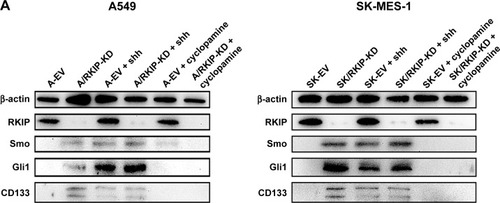 Figure 6 RKIP reduction enhances Shh–Gli1 signaling and increases CD133 expression in NSCLC cell lines.