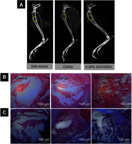 Figure 8 Healing images of rat tibial bone defects in vivo. (A) Representative X-ray photographs of bone defects of control clot (no filler), filled with GO/GN and filled with GO/CS/GN scaffolds after 2 weeks of implantation. (B) H&E staining and (C) Masson’s trichrome staining of rat tibial bone sections after 2 weeks of post-implantation. The scale bar is 100 μm.Notes: Reprinted from Saravanan S, Anjali C, Vairamani M, Sastry T, Subramanian K, Selvamurugan N. Scaffolds containing chitosan, gelatin and graphene oxide for bone tissue regeneration in vitro and in vivo. Int J Biol Macromol. 2017;104:1975–1985. Copyright 2017, with permission from Elsevier.Citation199