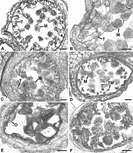 Fig. 3. Bromeliaceae anthers in cross section (LM). A. Puya floccosa, dyads and tetrads of microspores. B, C. Quesnelia edmundoi, enlarged tapetal cells and dyads and tetrads of microspores. D. Guzmania madisonii, tapetal material inside the locule. E. Pitcairnia paniculata, possible orbicules on the tapetal cells. F. Brocchinia reducta, possible orbicules on the tapetal cells. M=microspore, O=possible orbicule, T=tapetum, TM=tapetal material. Bars – 20 μm.