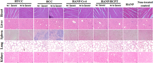 Figure 7 Representative photos of mice after different treatments and histological images of major organs using H&E staining. No noticeable abnormality was found in the heart, liver, spleen, lung, or kidney.