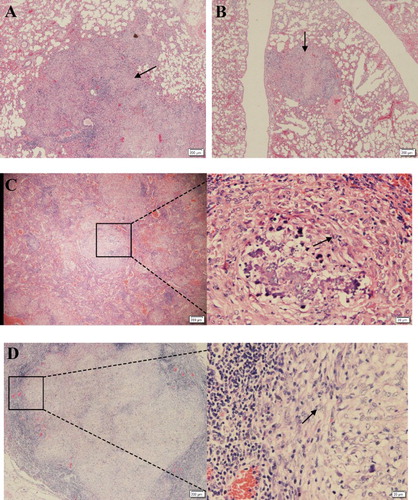 Figure 3. Histopathologic changes in selected tissues from infected guinea pigs. (A,B) Lung section of guinea pigs infection with 2 × 107 CFU of Mtb. Necrotic granulomas (arrow) were observed in the tissues from both right and left lung lobes at 20 weeks post-infection (×4). (C) Caseous necrosis in the centre of the lesions developed at 20 weeks post-infection, and the necrotic granuloma was confined by surrounding fibroblast (arrow) and fibrocyte in the spleen (×4). (D) Severe necrotizing fibrous granulomas were also appeared in the mesenteric lymph glands, also the necrotic granuloma was confined by surrounding fibroblast (arrow) and fibrocyte (×4).
