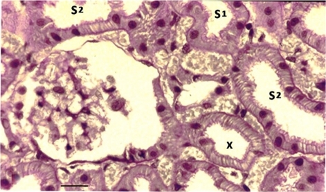 Figure 5. A PAS-stained freeze-substituted normal kidney showing a juxtamedullary nephron.Notes: The cells in the proximal tubular loop (X), descending from the glomerulus, have a typical S2-like structure. The scale bar represents 25 μm.