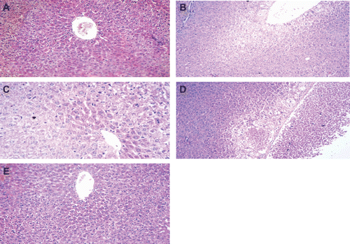 Figure 7.  Histology of liver sections recovered from rats in the various treatment groups. All images are 250× magnifications of H&E-stained tissues and are representative of samples from rats in each group. Section from: (a) sham-operated rat showing apparently normal liver except for mild central venous dilatation and congestion; (b) I/R-operated rat (control) showing disturbed architecture with necrosis and vacuolar degeneration around a dilated congested central vein; (c) histamine pre-treated rat showing minimal vacuolar degeneration peripherally; (d) rat that received thioperamide prior to histamine, showing massive central zonal necrosis around a dilated, engorged central vein with variable degrees of vacuolar degeneration; and (e) clozapine pre-treated rat showing mild vacuolar degeneration in hepatocytes and a dilated central vein.