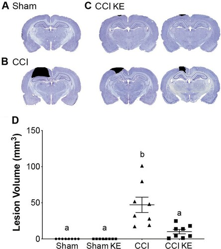 Figure 5. Quantification of lesion volume. Representative photomicrographs of coronal brain sections from (A) Sham, (B) CCI, and (C) CCI KE rats processed and stained four weeks post-injury. Black shading highlights contusion area quantified in each slice for final calculation of lesion volume. (D) Scatter plot of quantified lesion volume. Supplementation with KE significantly reduced the lesion volume. Error bars represent SEM. Sham and Sham KE rats were not included in the statistical analysis as there was no lesion to be quantified. (n = 8 rats/group; p < 0.01). b indicates statistical significance from CCI rats.