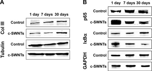 Figure 6 SWNTs stimulate the synthesis of collagen and activate NF-κB signaling in rat lungs.Notes: Western blotting analysis of total level of Col III (A) and cytoplasmic levels of NF-κB/p65 and IκBα (B) after intravenous injection for 1, 7, and 30 days.Abbreviations: SWNTs, single-walled carbon nanotubes; NF-κB, nuclear factor-kappa B; Col III, type-III collagen; IκBα, inhibitor of kappa B alpha; c-SWNTs, carboxylated SWNTs.
