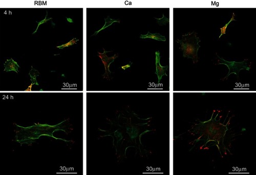 Figure 6 Merged confocal laser scanning microscopy (CLSM) images of the spread mesenchymal stem cells (MSCs) on the investigated surfaces showing actin cytoskeleton (green) and focal adhesions (red) at 4 and 24 hrs of incubation.