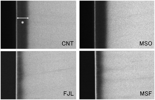 Figure 1. Representative TMR images. MSF and FJL had narrower demineralization zones than those of MSO and CNT. Also, MSF and FJL showed distinct radio-opaque surface layers as compared with other two groups.