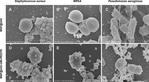 Figure 3 SEM images showing the targeting effect of (A–C) MXF@UiO and (D–F) MXF@UiO-UBI-PEGTK toward S. aureus, MRSA, and P. aeruginosa. Scale bar: 1 μm.