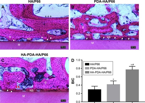 Figure 13 Histological analysis (H&E staining, ×100) of femoral condyle defects at 8 weeks after the surgery.Notes: (A) HA/P66. (B) PDA-HA/P66. (C) HA-PDA-HA/P66. (D) BIC%. White arrows indicate osteocytes, red arrows indicate osteoclasts-like cells, black arrows indicate osteoblasts, and black tailless arrows indicate osteoid. *Significant difference compared with HA/P66 (P<0.05). #Significant difference compared with PDA-HA/P66 (P<0.05).Abbreviations: B, bone; BIC, bone–implant contact; HA/P66, hydroxyapatite/polyamide 66; M, material; NB, new bone; PDA, polydopamine; PDA-HA/P66, polydopamine coating on hydroxyapatite/polyamide 66; HA-PDA-HA/P66, hydroxyapatite coating formation on hydroxyapatite/polyamide 66 assisted by polydopamine.