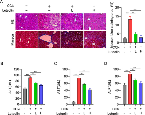 Figure 2 Effect of Luteolin treatment on liver fibrosis. (A) Representative images of HE and Masson-stained liver tissue treated with CCl4 and different concentrations of Luteolin (n-4). Bar=200um, 100X. (B–D) Serum ALT, AST, and ALP levels after treatment with CCl4 and different concentrations of Luteolin. “‑”, no treatment; “+”, treatment; “L”, 2uM; “H”, 10 uM. **P <0.01, ***P <0.001.