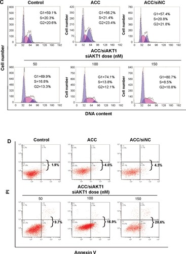 Figure 5 In vitro AKT1 silencing by ACC/CaIP6/siAKT1 transfection in MCF-7 cells.Notes: (A) AKT1 mRNA and protein expression after transfecting MCF-7 cells with ACC/CaIP6/siAKT1 complexes was assessed by real-time polymerase chain reaction and Western blots, respectively. ***P<0.001 versus control. (B) The MTT assay was used to assess MCF-7 cell viability after transfecting cells with ACC/CaIP6 complexes containing different concentrations of siAKT1 (*P<0.05, ***P<0.001 versus control). (C) Flow cytometry was used to determine the cell cycles of MCF-7 cells 48 hours after ACC/CaIP6/siAKT1 transfection. (D) Apoptosis was measured using Annexin V-phycoerythrin/propidium iodide staining for MCF-7 cells treated with various ACC/CaIP6/siRNA complexes (one of three replicates is shown).Abbreviations: ACC, amorphous cal cium carbonate; ACC/CaIP6, amorphous calcium carbonate hybrid nanospheres functionalized with a Ca(II)-inositol hexakisphosphate compound; siAKT1, small interfering AKT1; siNC, control small interfering RNA; OD, optical density; PI, propidium iodide.