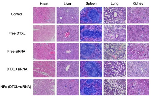 Figure 9 Histology hematoxylin and eosin (H&E) staining of major organs from mice after treatment with PBS and different formulations (original magnification ×200). No noticeable damages were observed in the NPs (DTXL + siRNA) group.Abbreviations: DTXL, docetaxel; NP, nanoparticle.