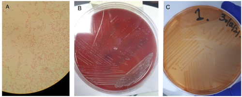 Figure 1 (A) Ralstonia mannitolilytica in Gram stain; (B) Ralstonia pickettii 72 hours culture on blood agar; (C) Ralstonia mannitolilytica 72 hour culture on MacConkey plate.