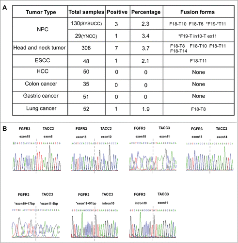 Figure 2. Different forms of FGFR3-TACC3 fusion transcripts present in a variety of solid tumors. (A) Frequency and different forms of the FGFR3-TACC3 fusion gene identified in different types of cancers. (B) Identification of the fusion breakpoint using Sanger sequencing.