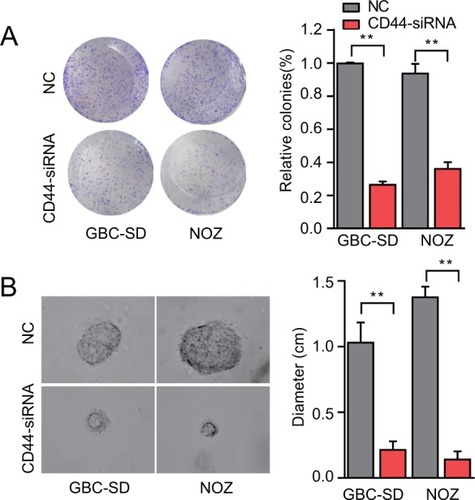 Figure 4 CD44 downregulation suppresses colony formation ability of CSCs.Notes: (A) The colony formation ability of CSCs treated with CD44-siRNA was decreased. (B) Formation of spheres from GBC cells transfected with CD44-siRNA accessed by three-dimensional cell culture. The diameter of cancer spheroids formed from GBC-SD cells with CD44 silencing was significantly smaller than the control group. All the results were reproducible in three independent experiments. **P<0.01.Abbreviations: CD44, cluster of differentiation 44; CSCs, cancer stem cells; GBC, gallbladder cancer; NC, nonspecific control siRNA.